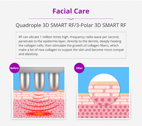 RF cavitation machine