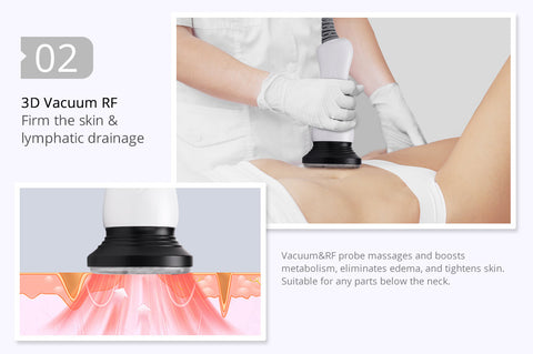 lipo cavitation