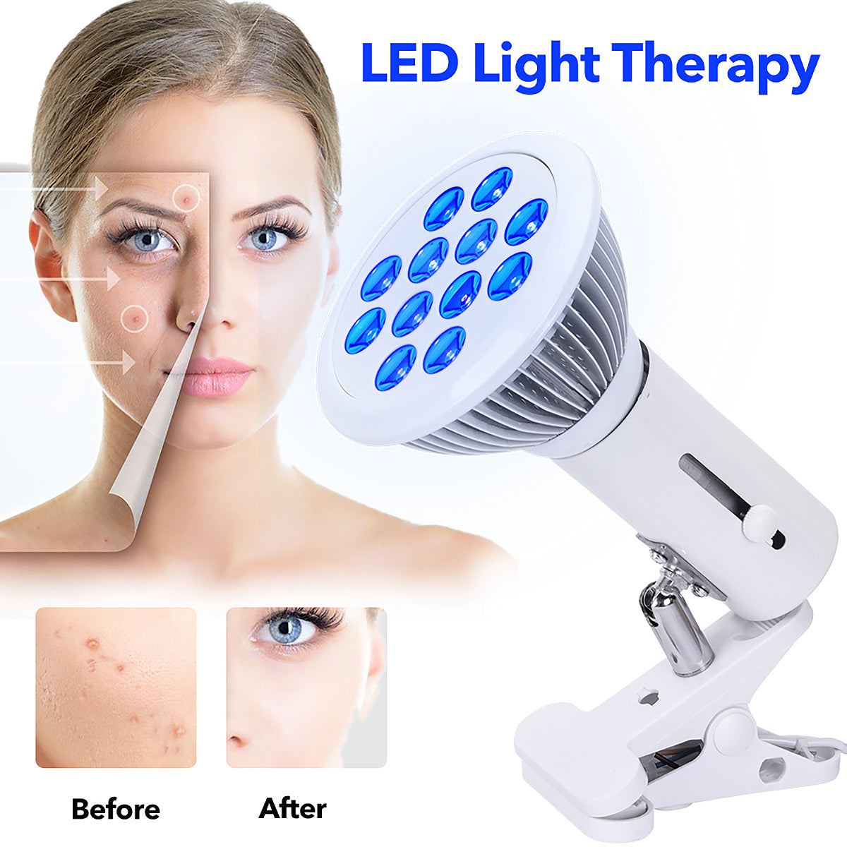 blue light therapy lamp for fatigue, acne, skin problems