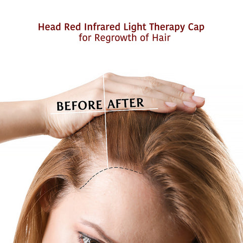 Brain Red & Infrared Therapy for Hair 660nm & 940nm – Lukirch®