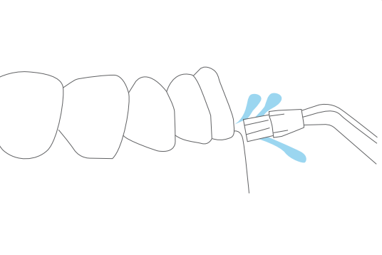 Plaque Brush Tip