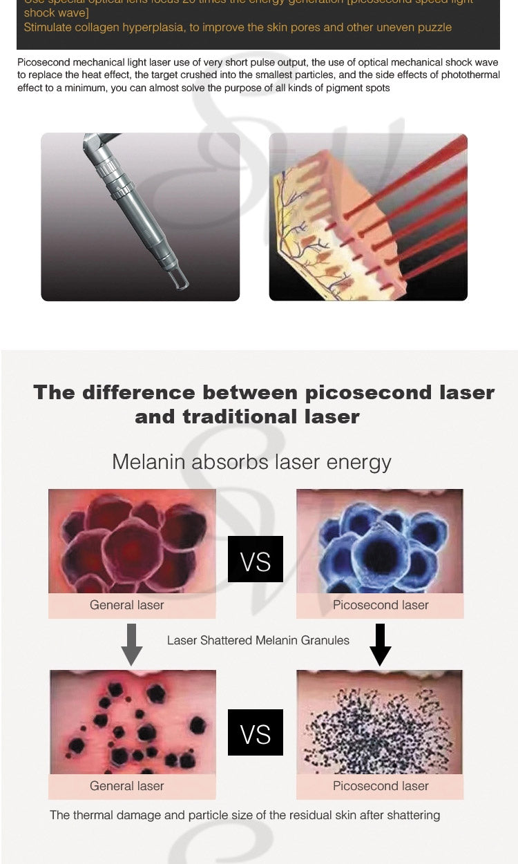 Picosure laser tattoo removal machine