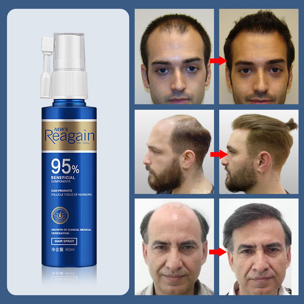 Reagain Ultimate?Anti?Hair?Loss Treatment