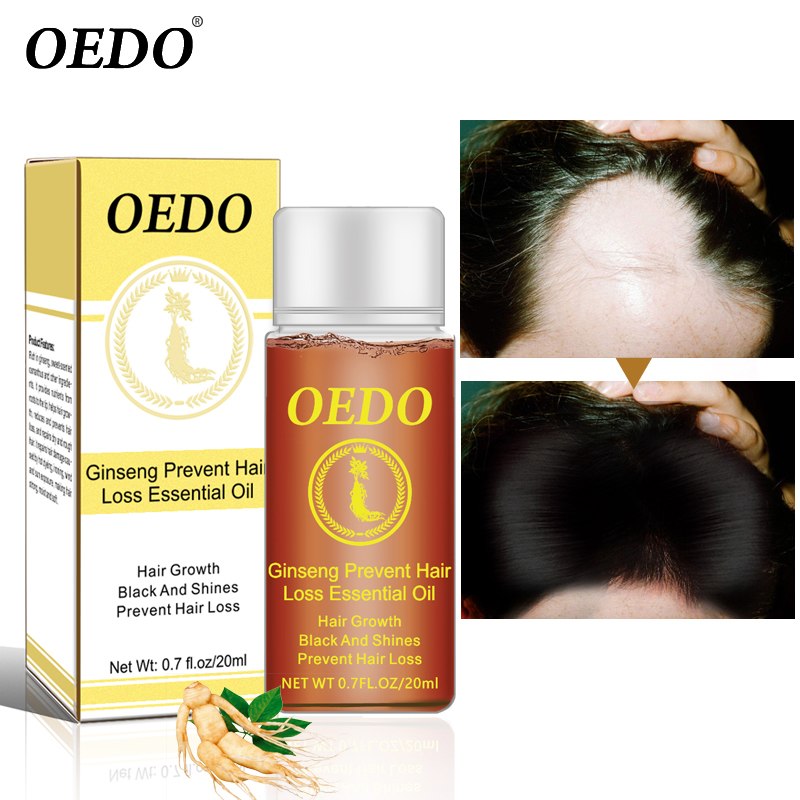 Ginseng Hair loss treatment OEDO