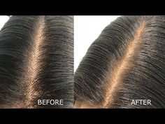 how to hide the knots without bleaching