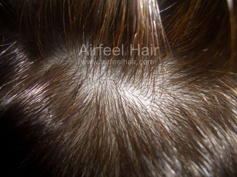 Airfeel hair stand injected