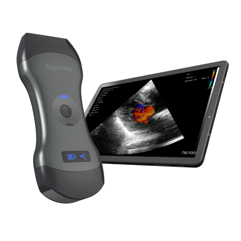 EagleView? Dual-head Wireless Handheld Ultrasound