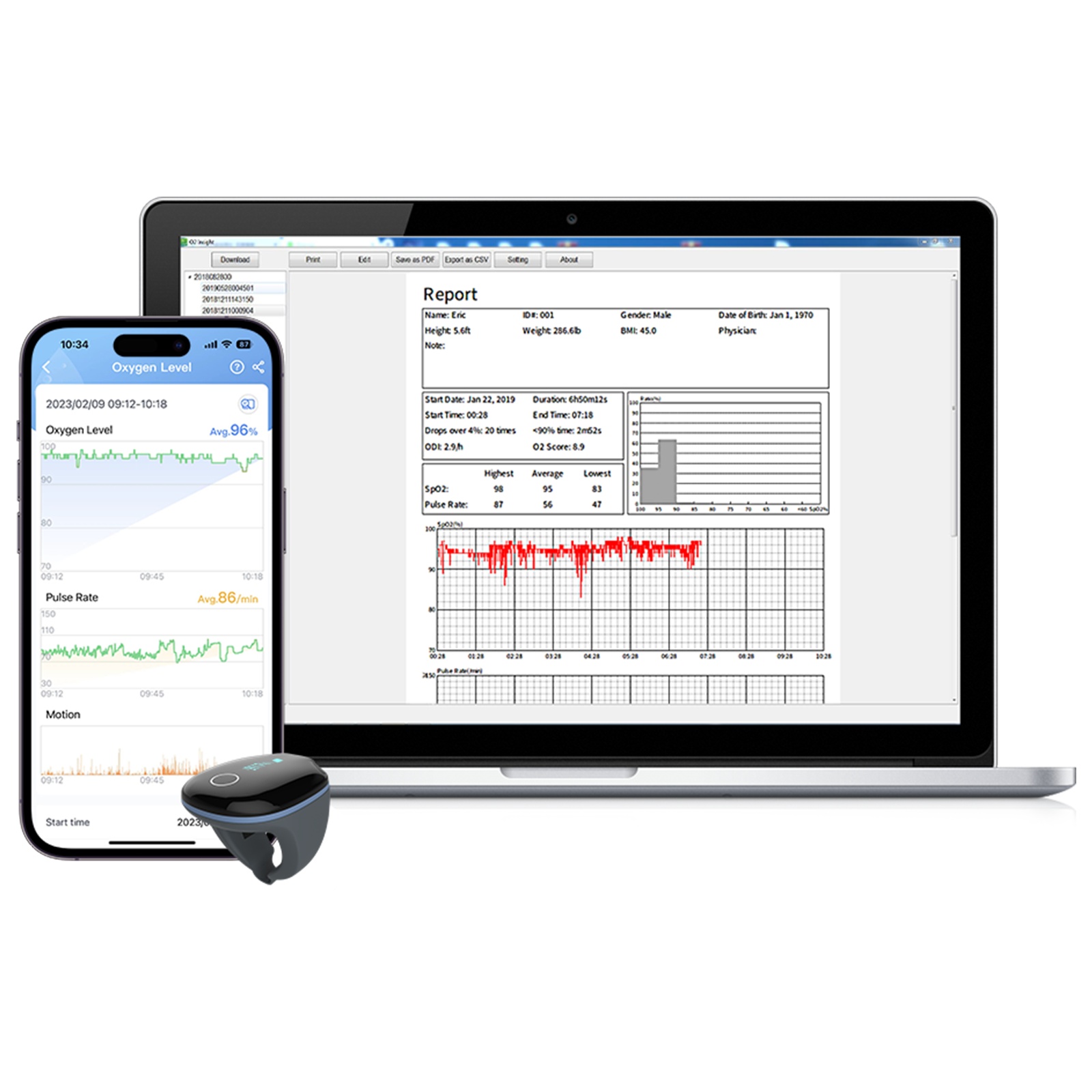 O2Ring? Continuous Ring Oxygen Monitor x2