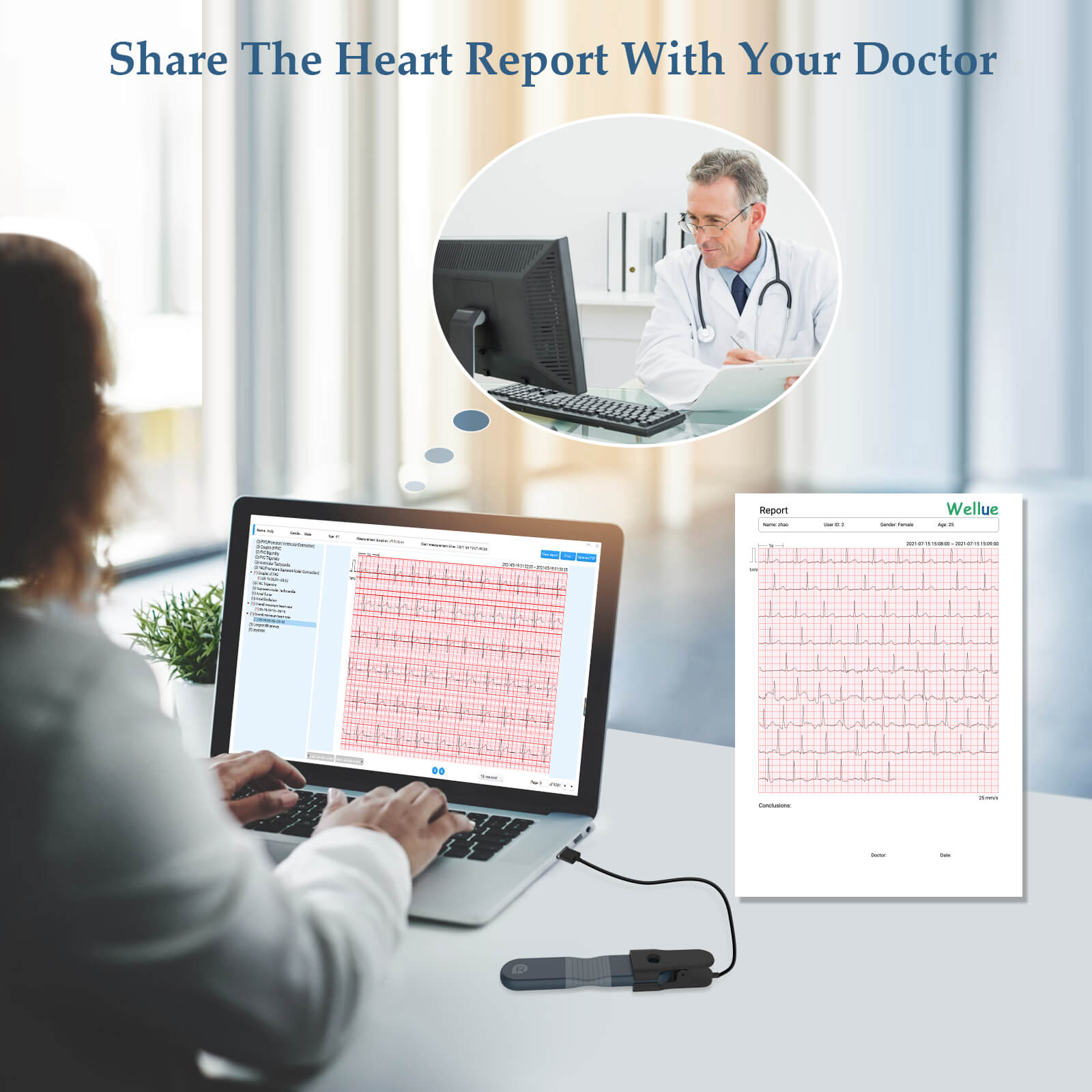 ECG Recorder with AI Analysis