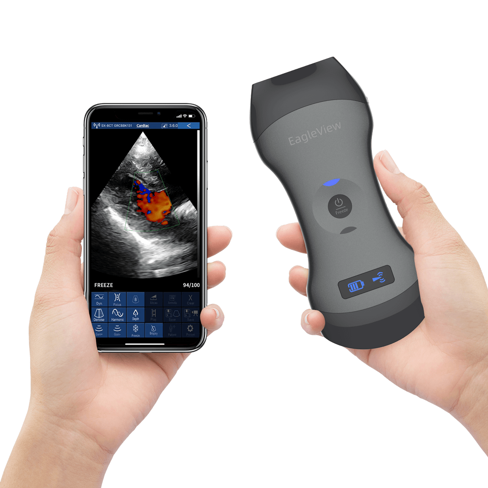 EagleView? Dual-head Wireless Handheld Ultrasound