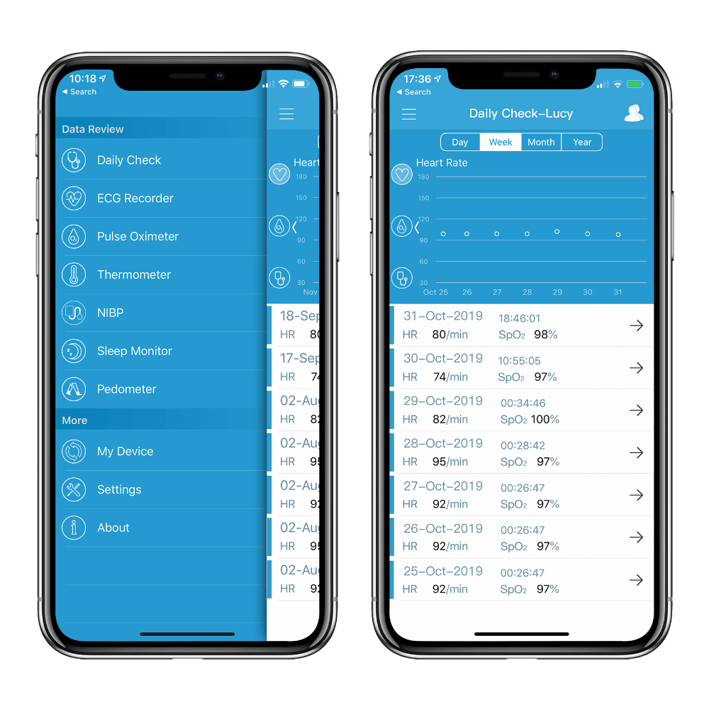 Checkme? Pro Vital Signs Monitor