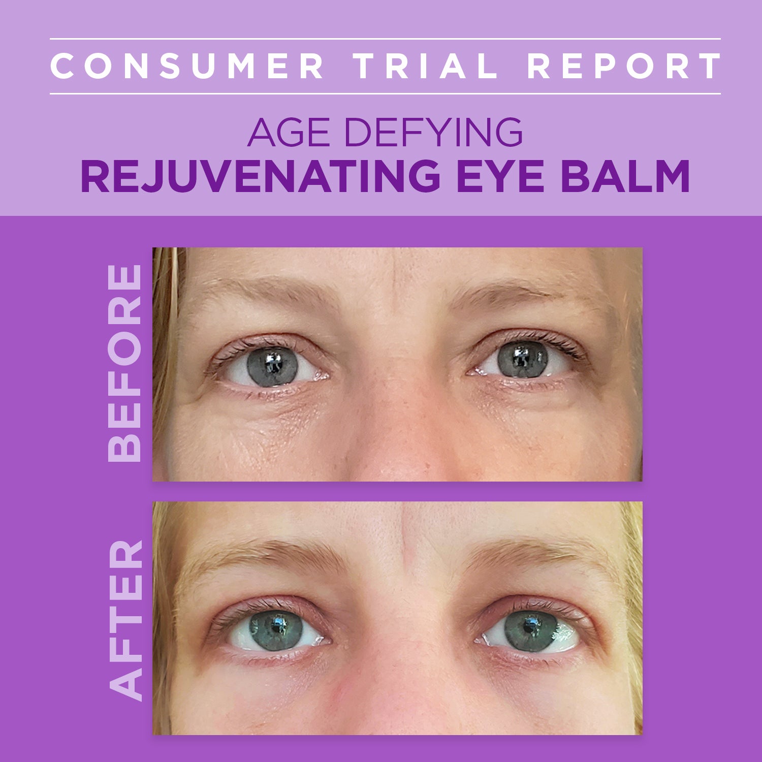 Age Defying Rejuvenating Plant-Based Retinol Alternative Eye Balm
