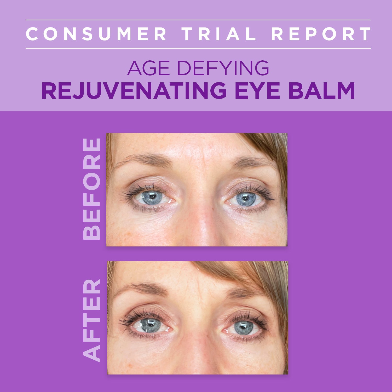 Age Defying Rejuvenating Plant-Based Retinol Alternative Eye Balm