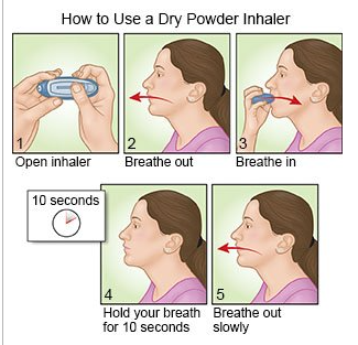 How to Use a Dry Powder Inhaler