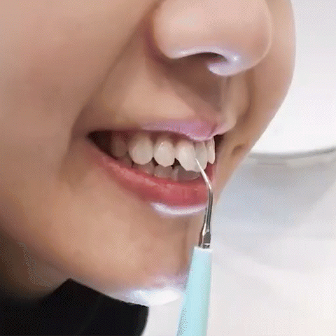 Limpador Dental Ultrassônico