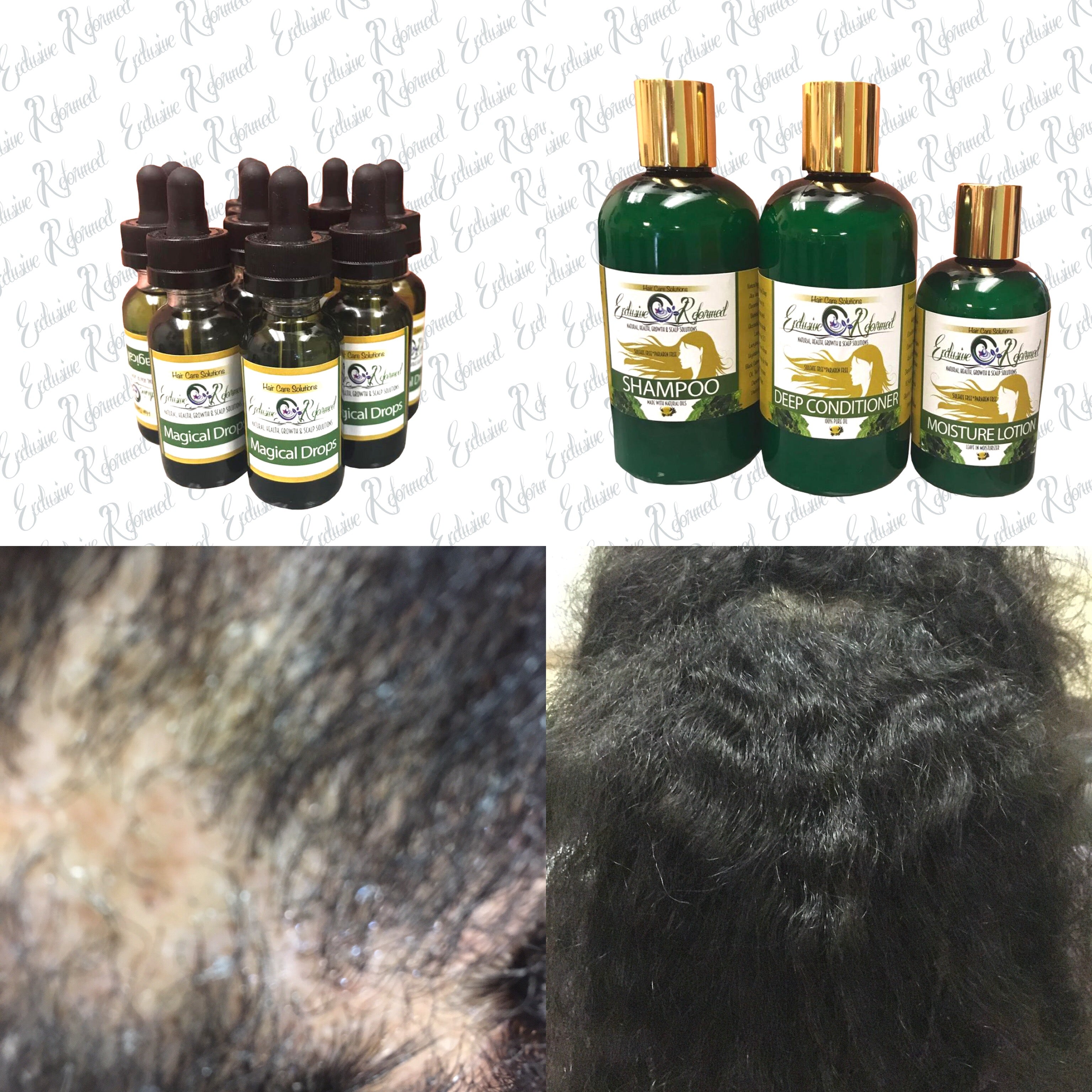 Daily hair care Help thicken hair Boosts circulation to follicles Growth hair