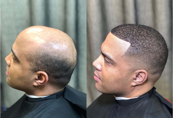 Male Hair Units