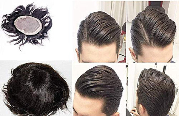 buy hair patch