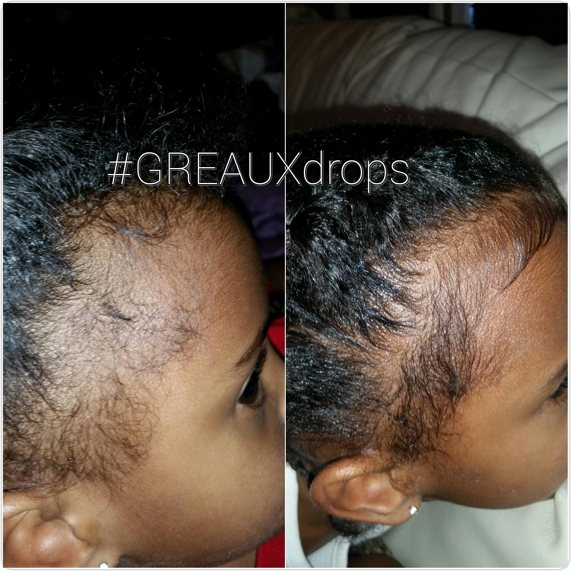 GREAUX Healthy Hair Drops