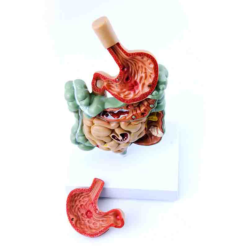 Gastrointestinal Disease Model