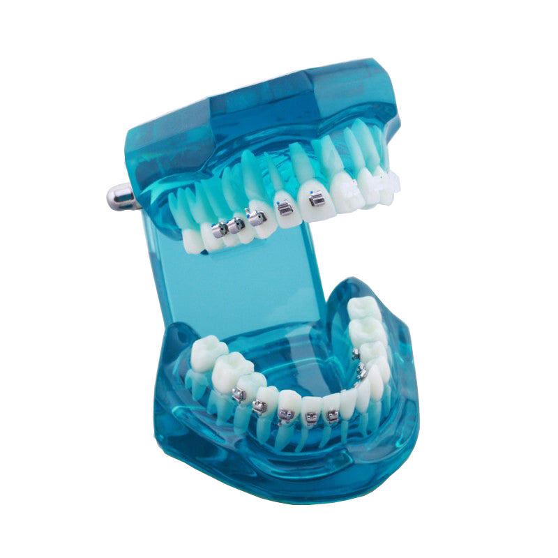 W3012 Dental Orthodontic Model with Self-Ligating Bracket