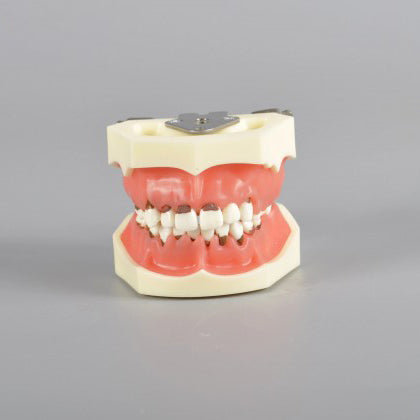 W4024 Dental Periodontal Model with 3 Cases