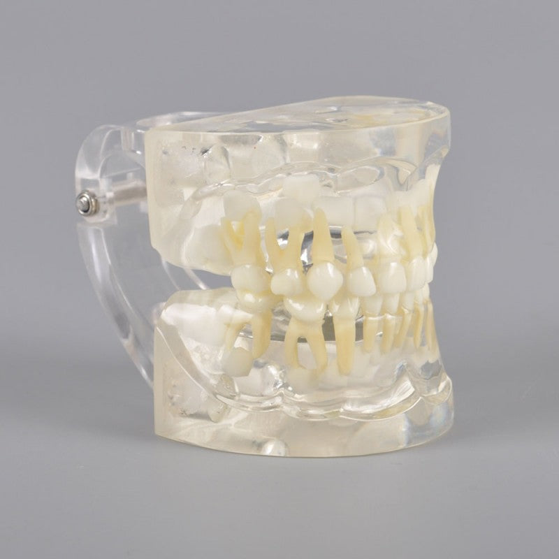 W7017 Pediatric Dental Model - 3 Years Old