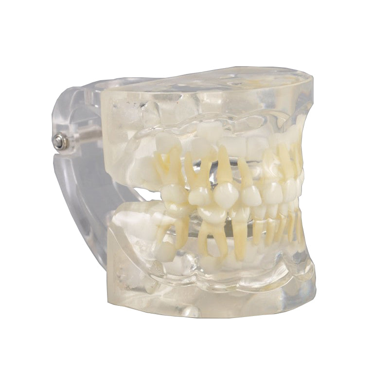 W7017 Pediatric Dental Model - 3 Years Old