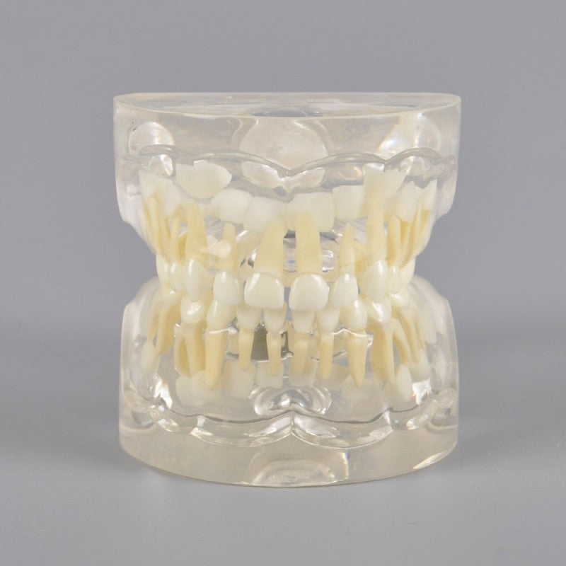W7017 Pediatric Dental Model - 3 Years Old