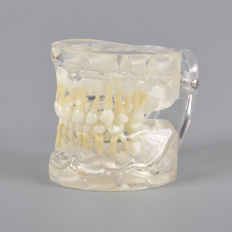 W7017 Pediatric Dental Model - 3 Years Old