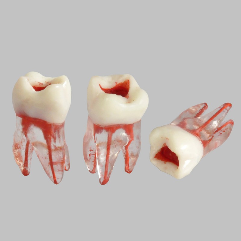 W8008 Root Pulp Cavity Model for Training or Practice