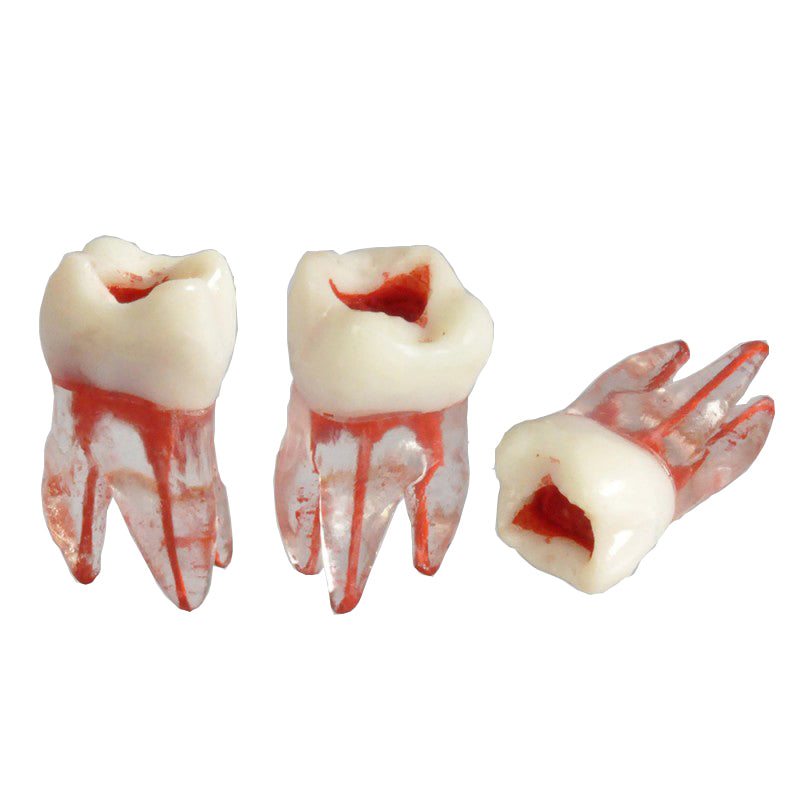 W8008 Root Pulp Cavity Model for Training or Practice