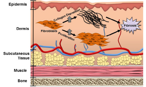 The mechanism of Red light therapy