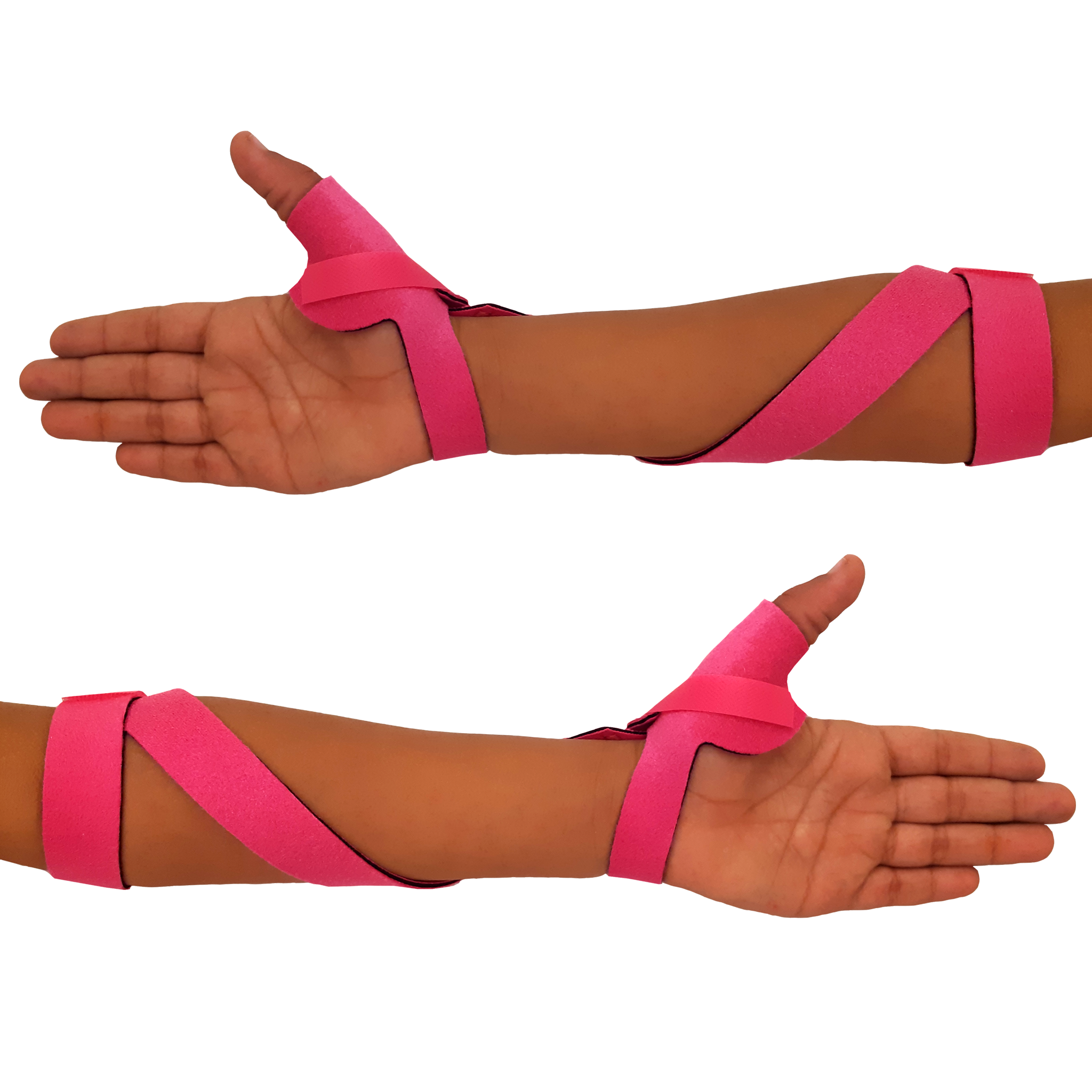 McKie Supination Strap & Thumb Splint Bundle (Pediatric Sizes)