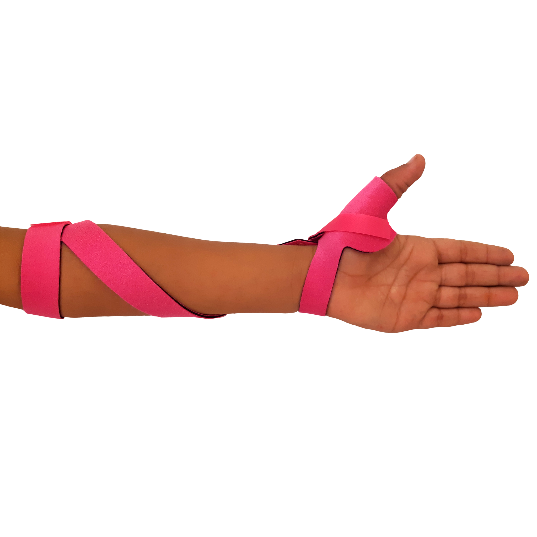 McKie Supination Strap & Thumb Splint Bundle (Pediatric Sizes)