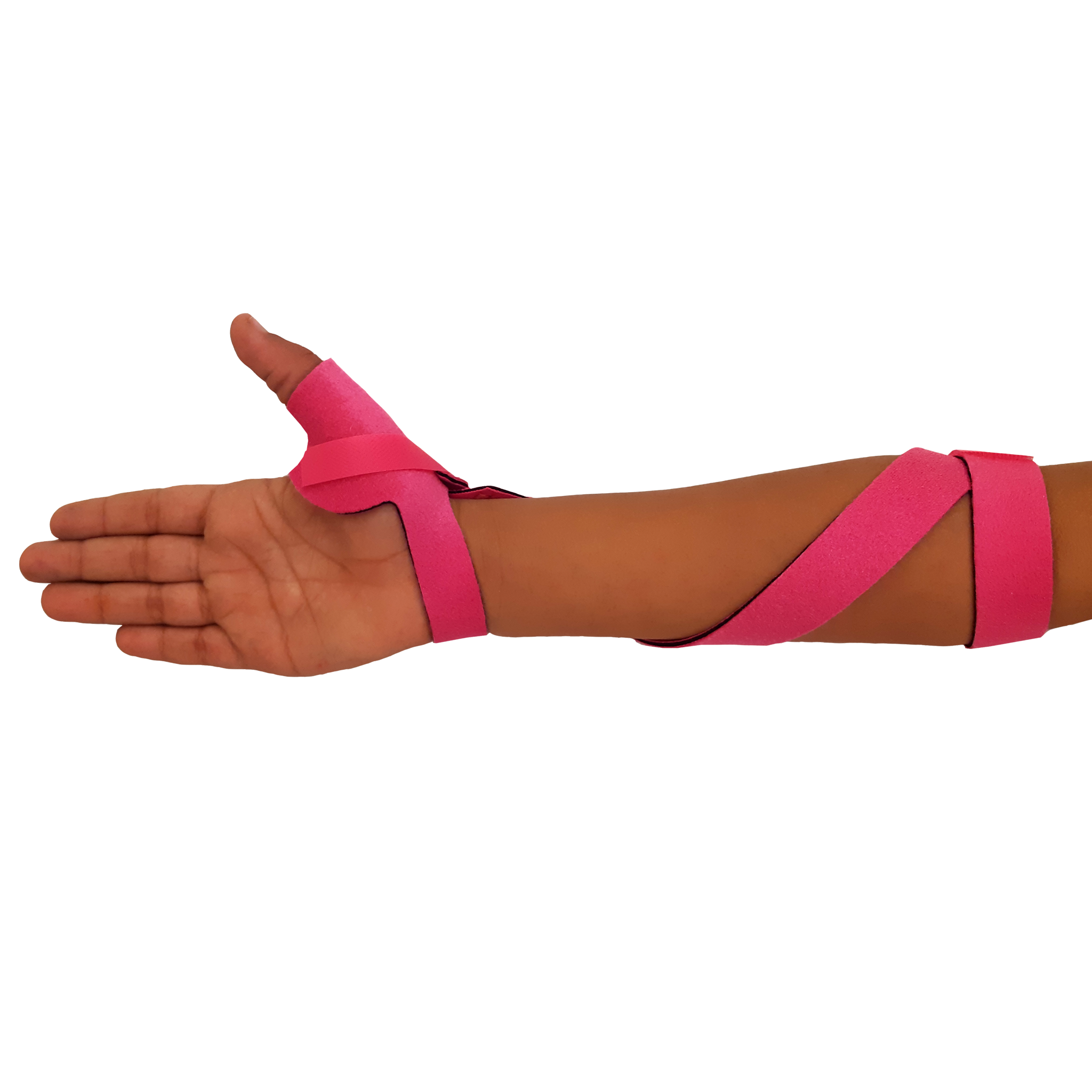 McKie Supination Strap & Thumb Splint Bundle (Pediatric Sizes)