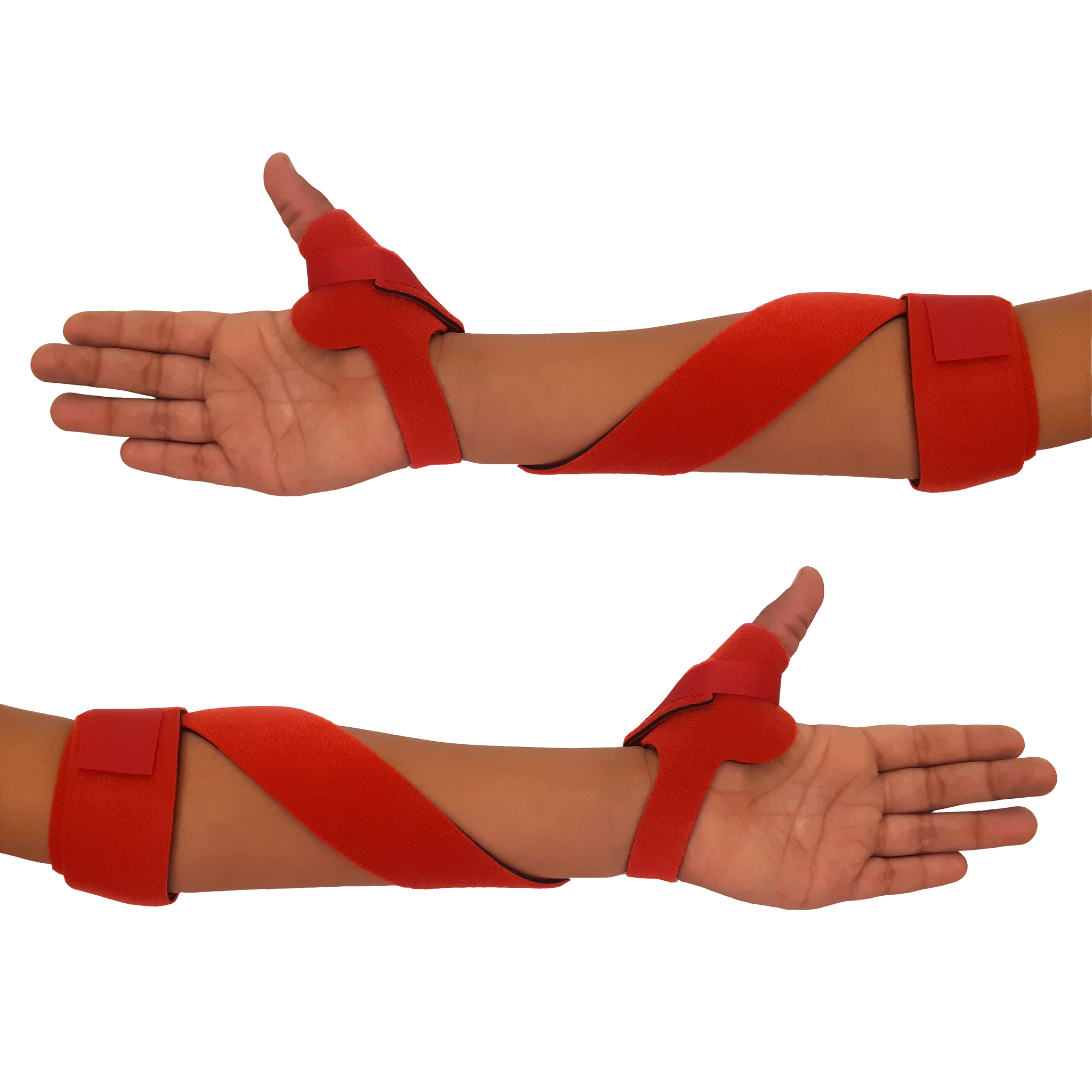 McKie Supination Strap & Thumb Splint Bundle (Pediatric Sizes)