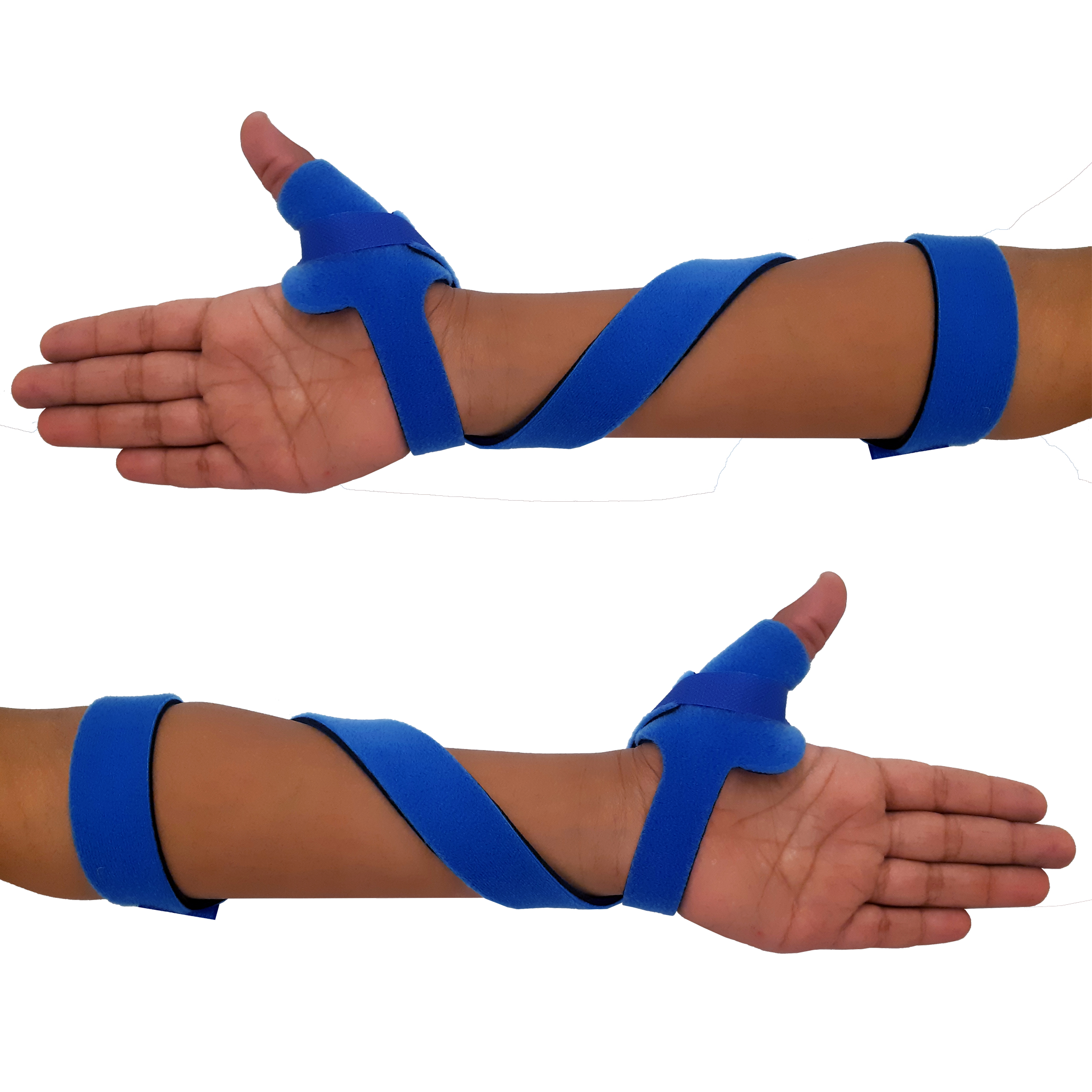 McKie Supination Strap & Thumb Splint Bundle (Pediatric Sizes)