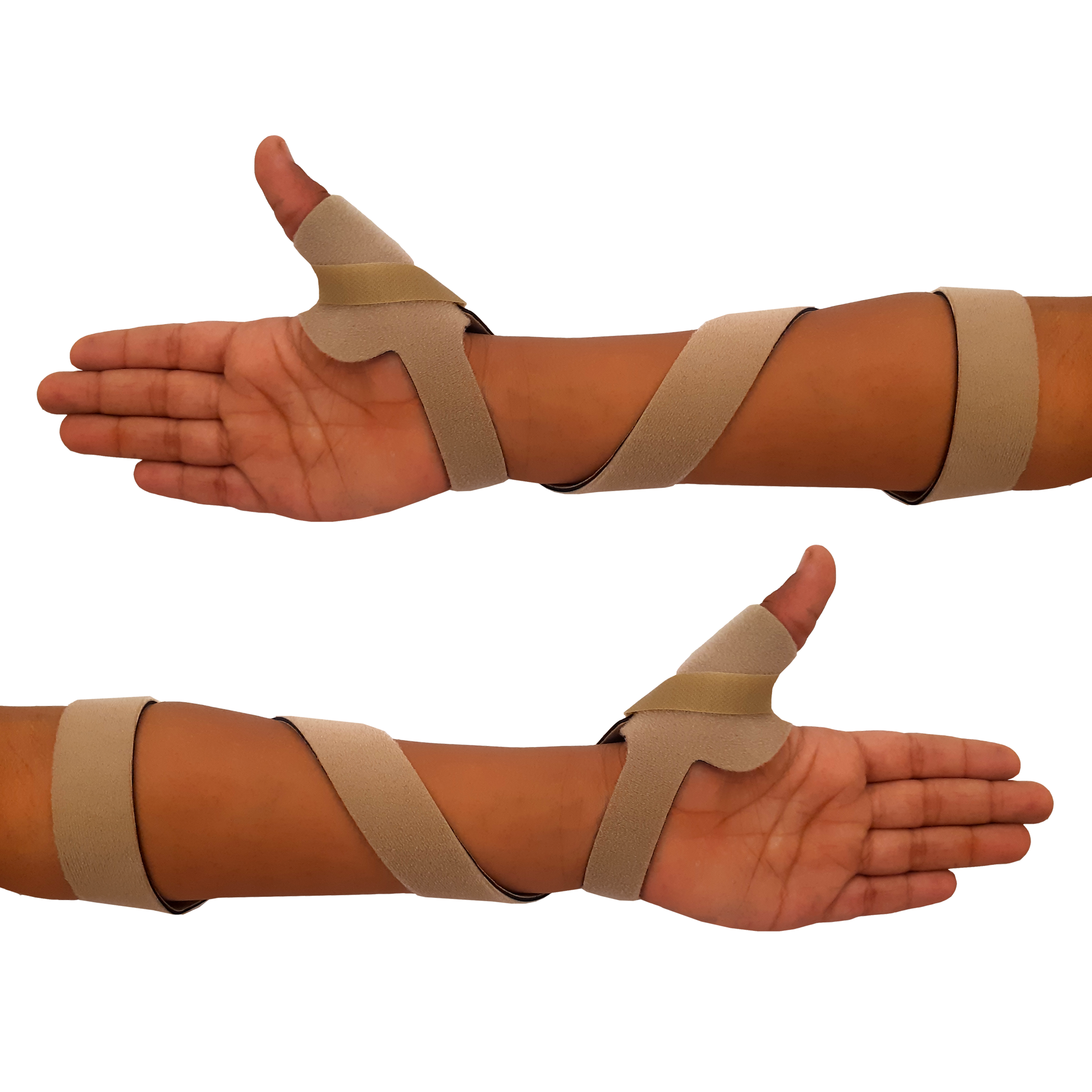 McKie Supination Strap & Thumb Splint Bundle (Pediatric Sizes)