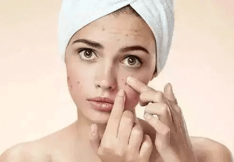 how to remove pimples overnight with home remedies