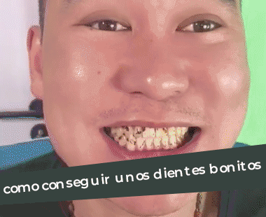 espuma blanqueadora  de dientes VIVISWEET