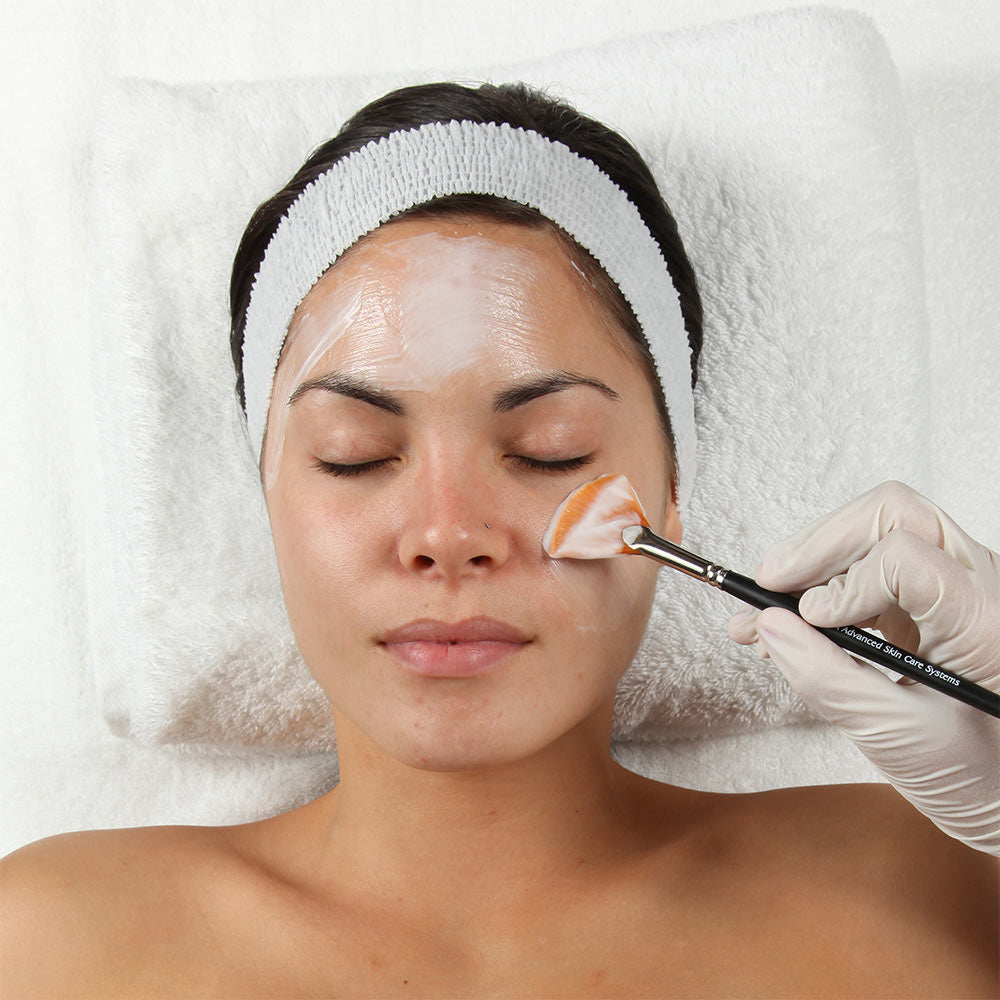 Vitalize Chemical Peel