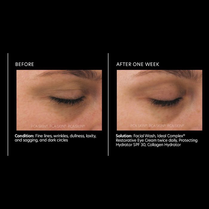 PCA Skin Ideal Complex? restorative eye cream 0.5 oz