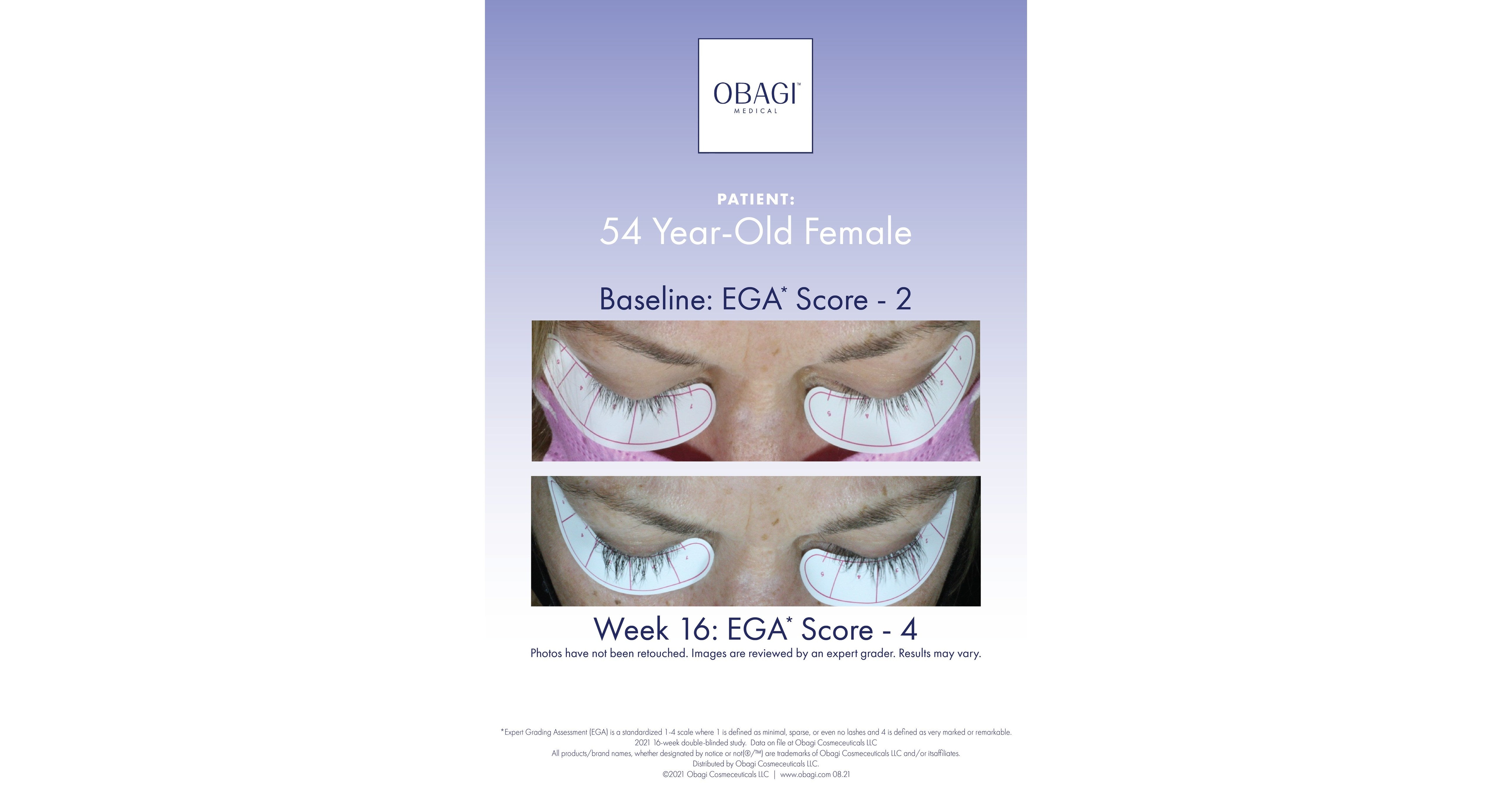 Obagi Medical Nu-Cil? Eyelash Enhancing Serum