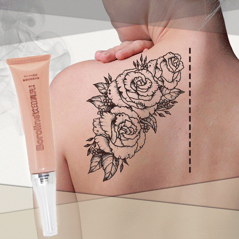 BOROLINE™ Tattoo Removal Cream – Peakmos
