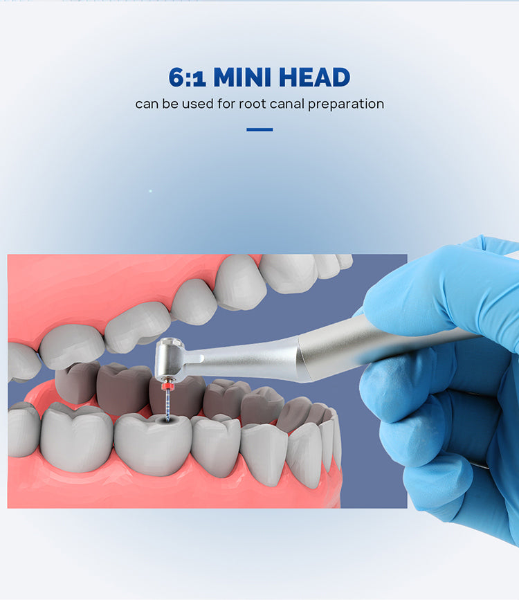 Dental 6:1 Reduction Endo Handpiece Contra Angle Mini Head Push Button - azdentall.com