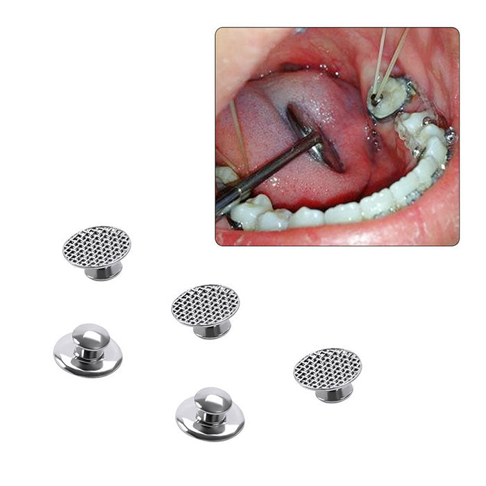 AZDENT Dental Lingual Button Orthodontic Metal Round Mesh Base Bondable 10/Bag AZDENT Dental Lingual Button Orthodontic Metal Round Mesh Base Bondable 10/Bag