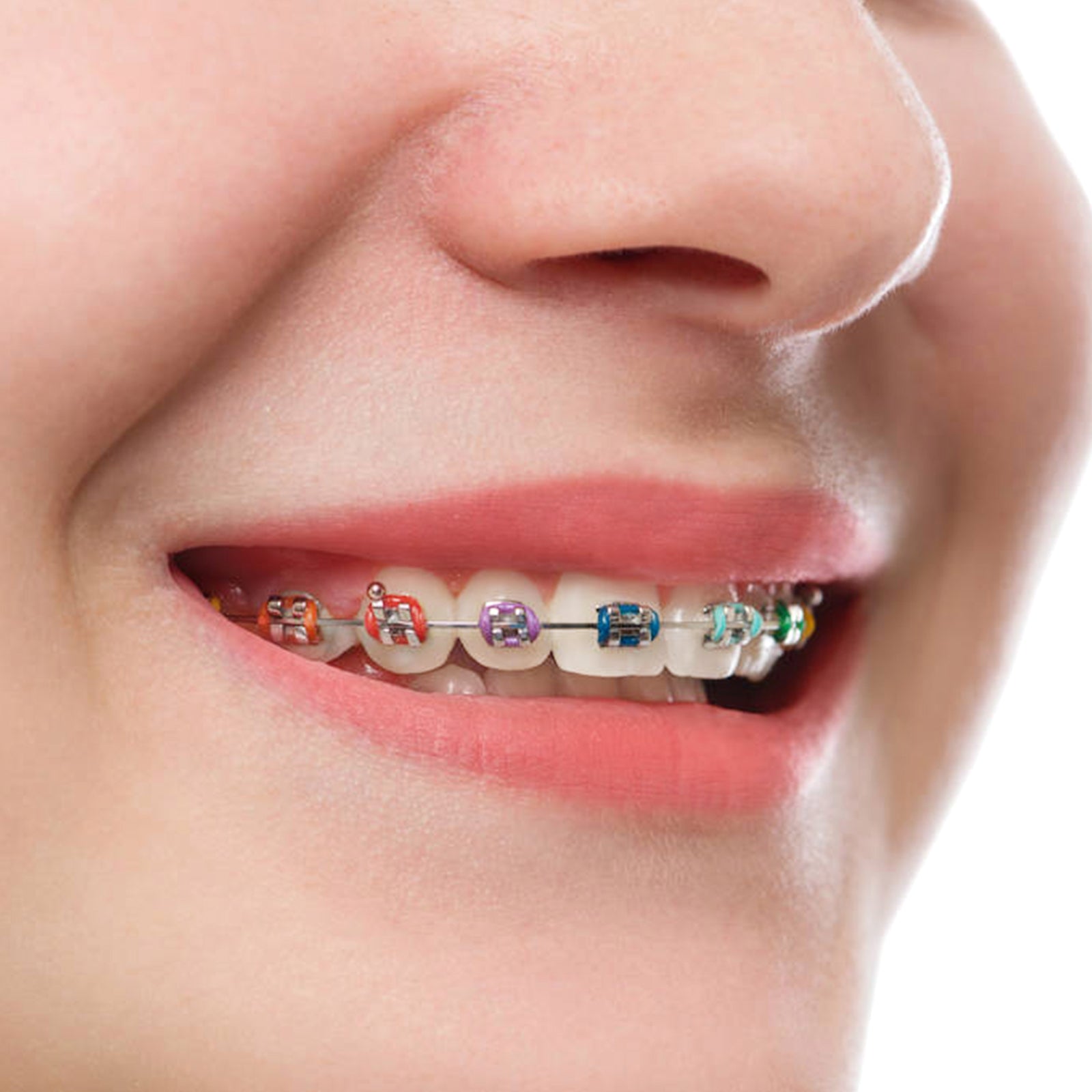 AZDENT Orthodontic Ligature Ties Multi-Color & Clear Color 1014 pcs/pack