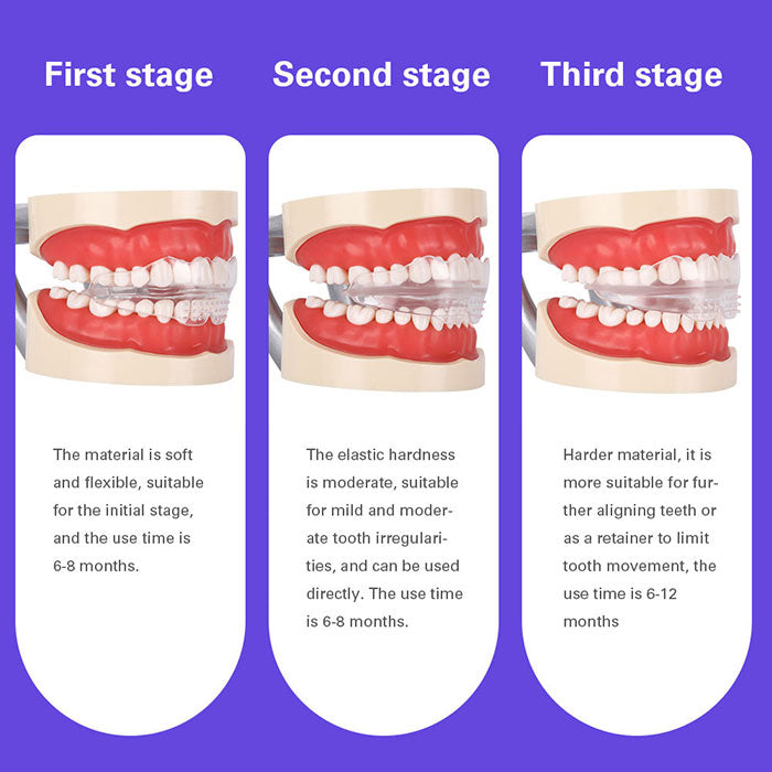Alignment Trainer Retainers Orthodontic Braces Appliance Tooth Corrector Adult 3 Stages-azdentall.com Alignment Trainer Retainers Orthodontic Braces Appliance Tooth Corrector Adult 3 Stages-azdentall.com