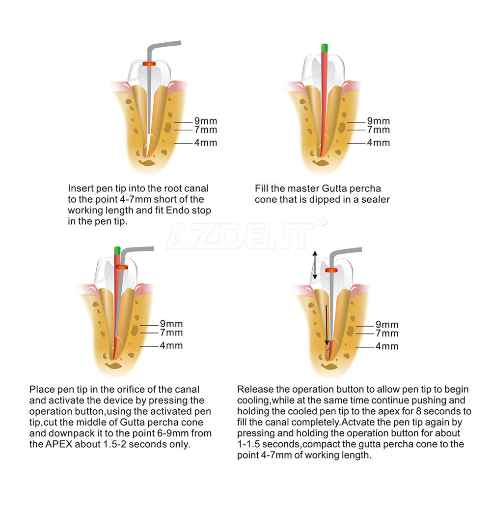 Dental Cordless Gutta Percha Obturation System Endo Heated Pen With 2 Tips Dental Cordless Gutta Percha Obturation System Endo Heated Pen With 2 Tips